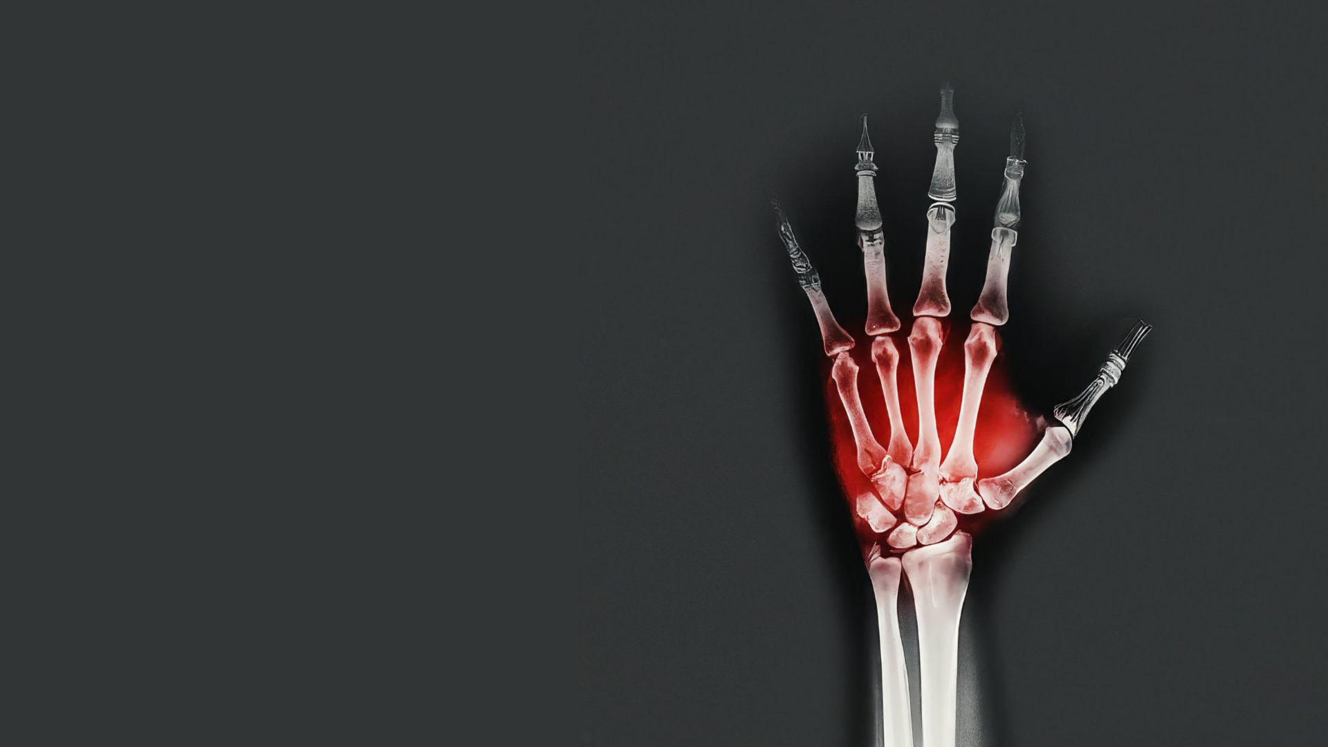 Cape Joint Surgery Hand Surgery